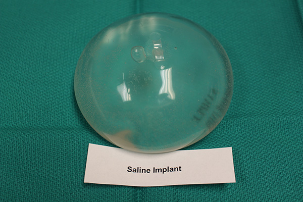 Saline Implant